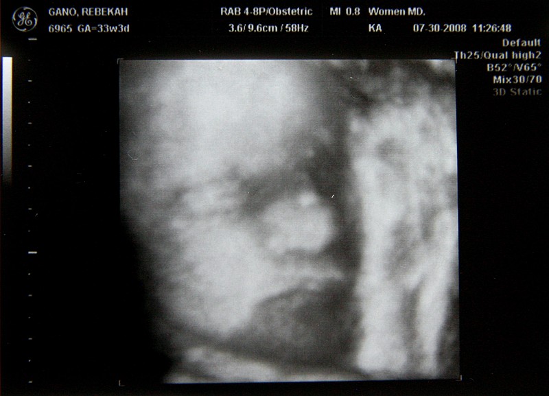 CRW_8234_JFR.JPG - Latest Ultrasound